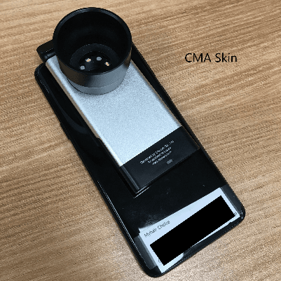 CMA skin device 1