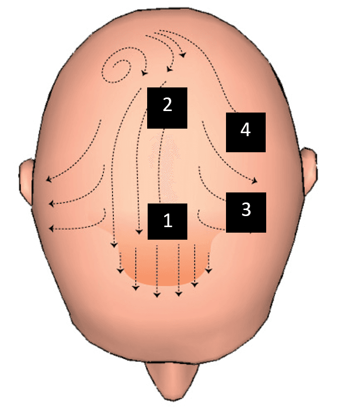 Figure  1